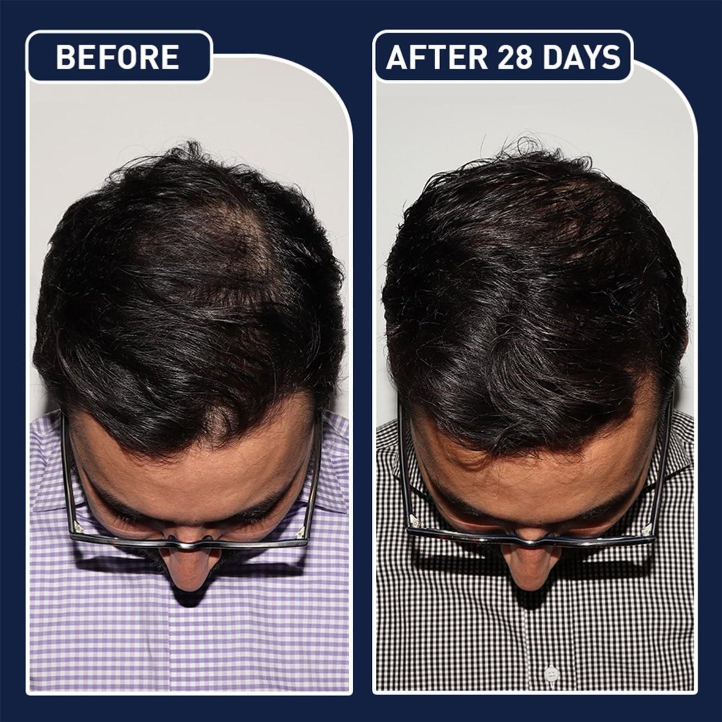 EFGPLUS Hair Growth Spray after use