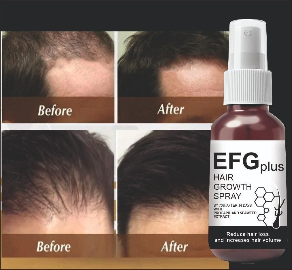 EFGPLUS Hair Growth Spray before after