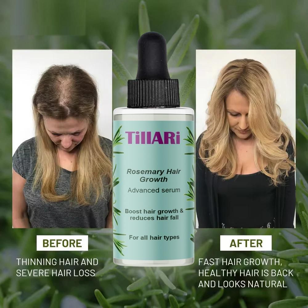 Tillari Rosemary Hair Growth Serum pack