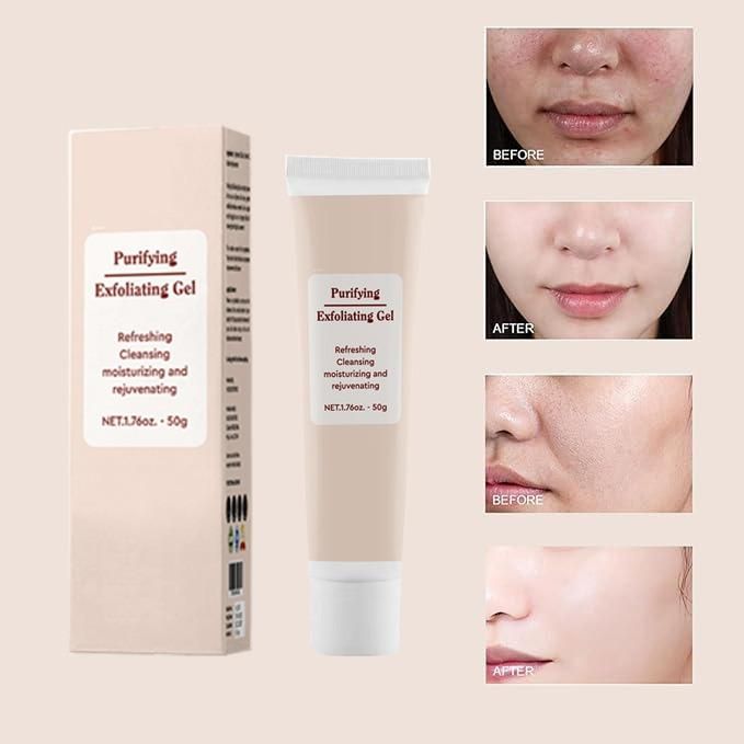 Purifying Exfoliating Gel 50g Pack of 1