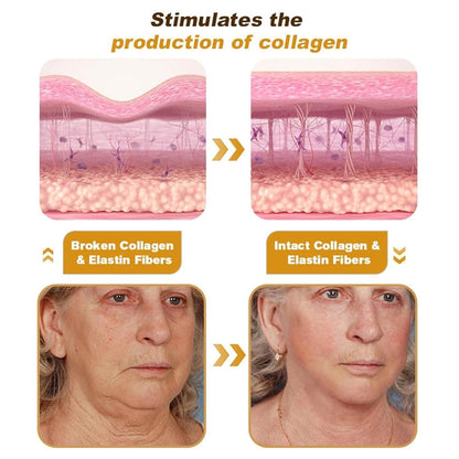 Botox Bee Venom Cream collagen