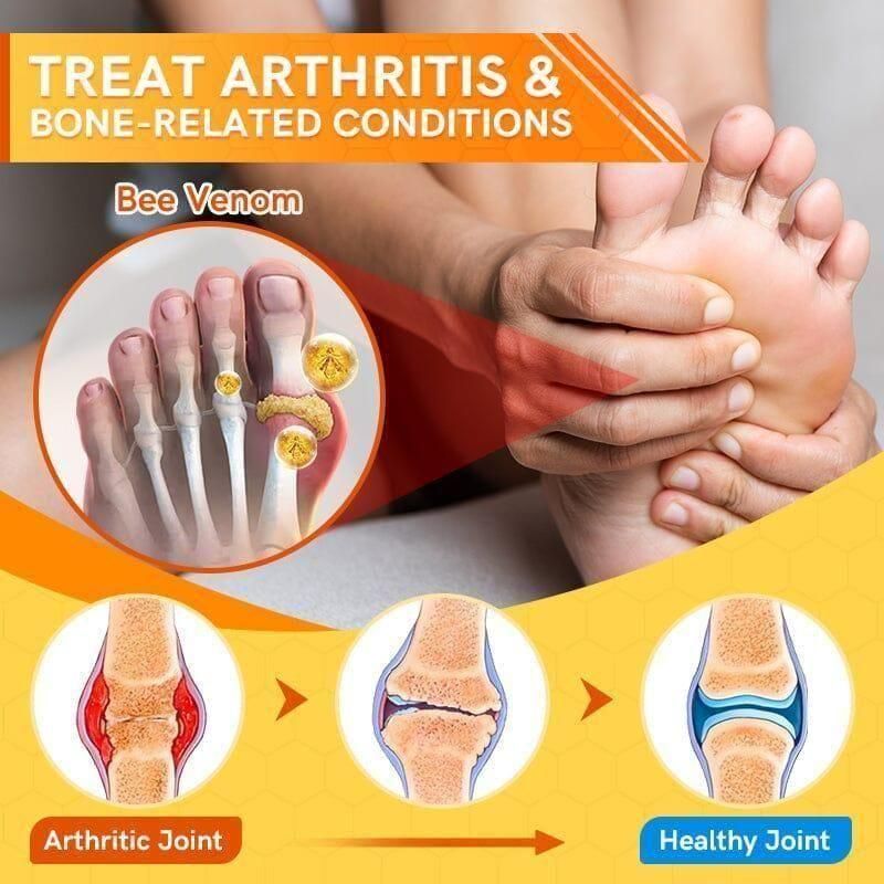 Bee Venom Spider Veins Spray  arthiritic Joint