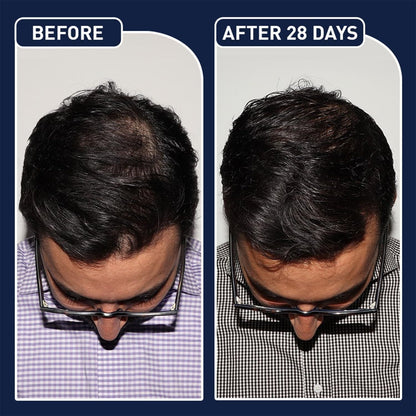 EFGPLUS Hair Growth Spray after use