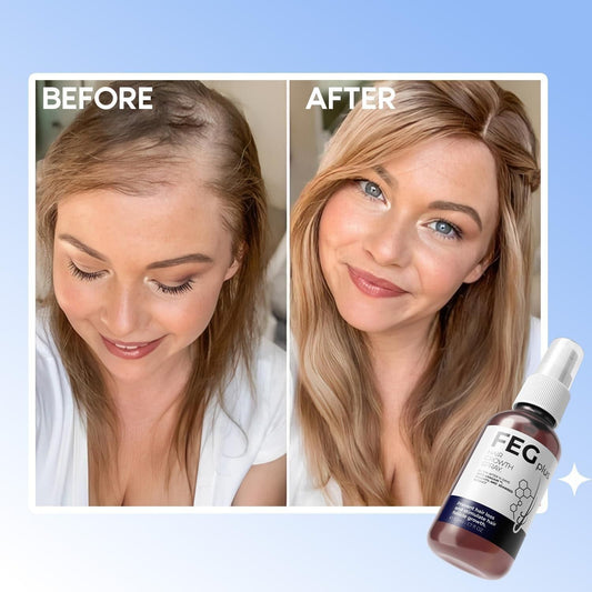 EFGPLUS Hair Growth Spray before after