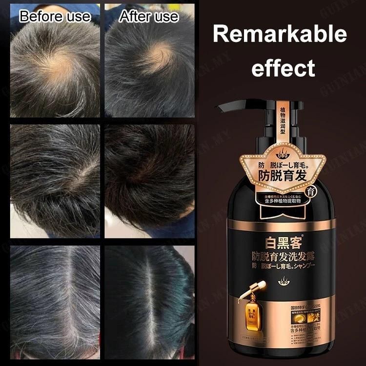 Anti Hair Loss Shampoo 300ml before after