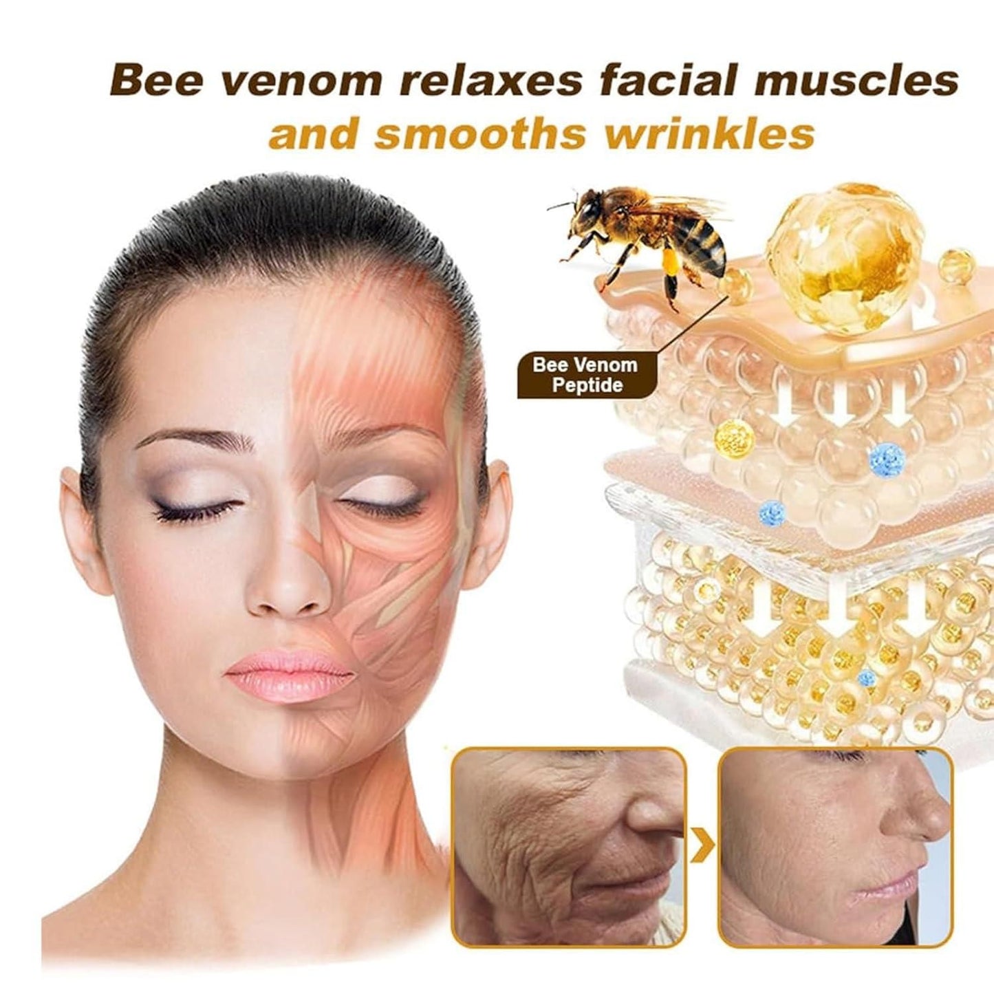 Botox Bee Venom Cream wrinkles