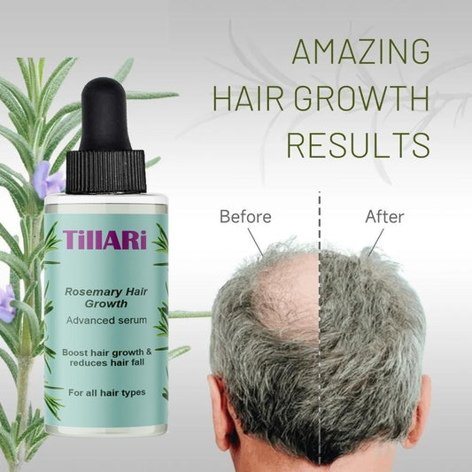 Tillari Rosemary Hair Growth Serum before after