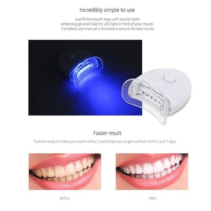 Teeth Cleaning & Whitening Kit faster result