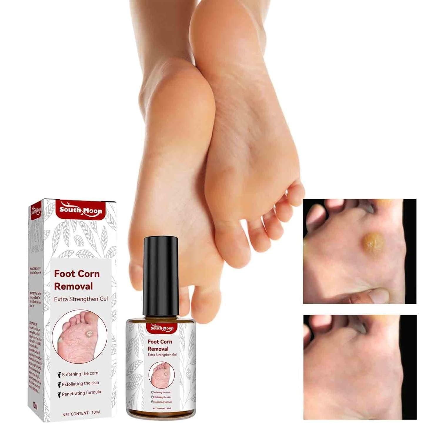Feet Corn Removal Serum before after